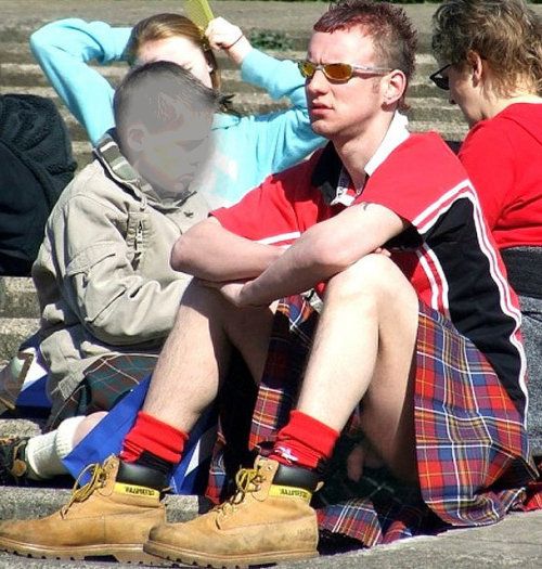 Dick slip from a man wearing a kilt