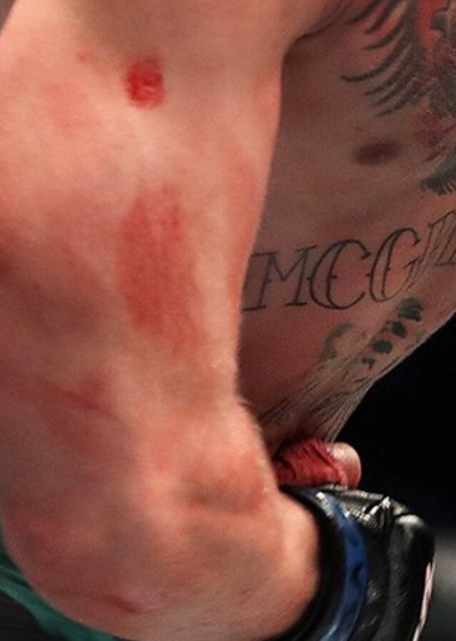 conor mcgregor dick slip during fight